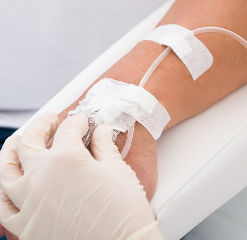 Dentist putting in IV for calm and stress-free procedures