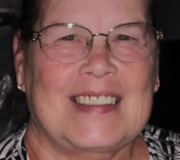 Middle-aged woman smiling after full dental treatment at Walton Dental Greenwood IN.