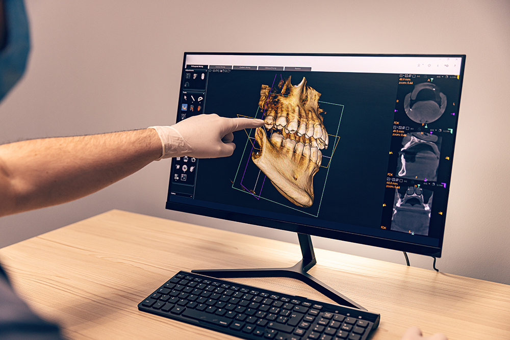 A 3d image of the jaw and teeth is shown on a computer screen